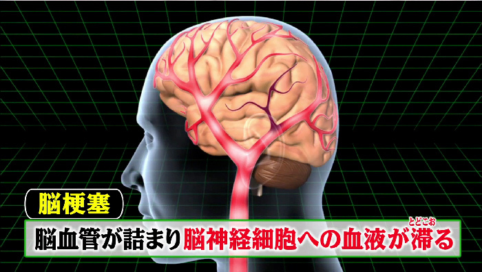 若い人も要注意 隠れた病気が自宅で分かる Diy健康診断 世界一受けたい授業 日本テレビ