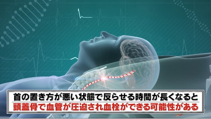 健康体の人が突如脳卒中に…生活における意外な原因とは？｜THE突破ファイル｜日本テレビ